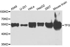 Western blot analysis of extracts of various cell lines, using TFG antibody (ABIN5975639) at 1/1000 dilution. (TFG Antikörper)