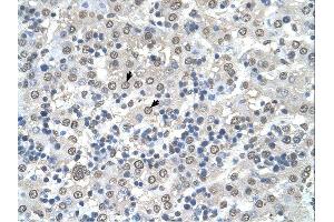 CDR2 antibody was used for immunohistochemistry at a concentration of 4-8 ug/ml. (CDR2 Antikörper  (N-Term))