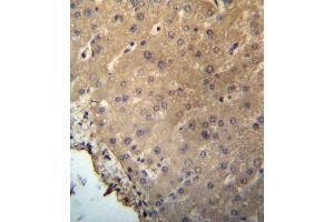 CHB Antibody (N-term) (ABIN657226 and ABIN2846328) immunohistochemistry analysis in formalin fixed and paraffin embedded human liver tissue followed by peroxidase conjugation of the secondary antibody and DAB staining. (CHMP2B Antikörper  (N-Term))