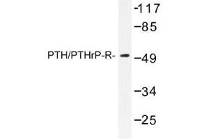 Image no. 1 for anti-Parathyroid Hormone 1 Receptor (PTH1R) antibody (ABIN317698) (PTH1R Antikörper)