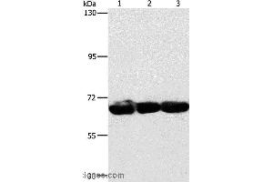 Western blot analysis of 293T, hepG2 and A549 cell, using CKAP4 Polyclonal Antibody at dilution of 1:750 (CKAP4 Antikörper)