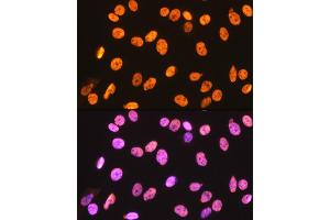 Immunofluorescence analysis of C6 cells using hnRNP U Rabbit mAb (ABIN1679689, ABIN3018741, ABIN3018742 and ABIN7101656) at dilution of 1:100 (40x lens). (HNRNPU Antikörper)