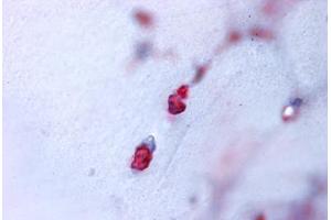 Human Bone, Cartilage (formalin-fixed, paraffin-embedded) stained with ACAN antibody ABIN625841 at 7 ug/ml followed by biotinylated goat anti-rabbit IgG secondary antibody ABIN481713, alkaline phosphatase-streptavidin and chromogen. (Aggrecan Antikörper  (N-Term))