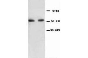 Western blot with NFκBP65 Polyclonal Antibody (NF-kB p65 Antikörper  (N-Term))