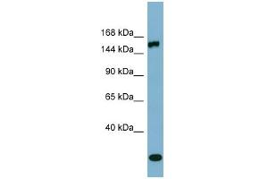 WB Suggested Anti-EPRS Antibody Titration:  0. (EPRS Antikörper  (Middle Region))
