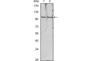 Western blot analysis using HDAC4 mouse mAb against Hela (1), Jurkat (2) cell lysate. (HDAC4 Antikörper)
