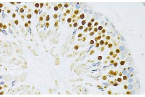 Immunohistochemistry of paraffin-embedded Rat testis using TFDP1 Polyclonal Antibody at dilution of 1:100 (40x lens). (DP1 Antikörper)