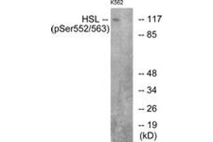 Western blot analysis of extracts from K562 cells, using HSL (Phospho-Ser552) Antibody. (LIPE Antikörper  (pSer552))