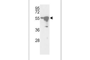 Western blot analysis of hYSK- (ABIN392471 and ABIN2842055) in Ramos and HepG2 cell line lysates (35 μg/lane). (YSK (AA 325-356), (C-Term) Antikörper)