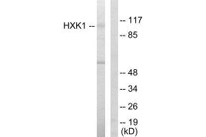 Western Blotting (WB) image for anti-Hexokinase 1 (HK1) (N-Term) antibody (ABIN1849225) (Hexokinase 1 Antikörper  (N-Term))