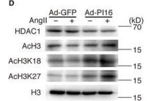 Western Blotting (WB) image for anti-Histone Deacetylase 1 (HDAC1) antibody (ABIN2854776)