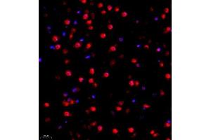 Immunofluorescence of paraffin embedded mouse brain using FUS (ABIN7075919) at dilution of 1:1000 (400x lens) (TLS/FUS Antikörper)