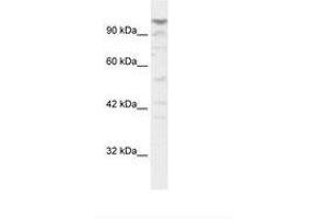 Image no. 1 for anti-La Ribonucleoprotein Domain Family, Member 1B (LARP1B) (AA 701-750) antibody (ABIN202965) (LARP1B Antikörper  (AA 701-750))