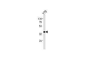 Western blot analysis in Y79 cell line lysates (35ug/lane). (SIX3 Antikörper  (AA 138-166))