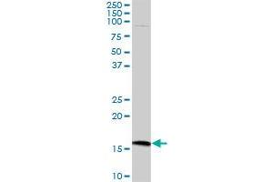 CMTM5 MaxPab polyclonal antibody. (CMTM5 Antikörper  (AA 1-156))