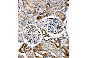 Anti-WISP1 antibody, IHC(P) IHC(P): Rat Kidney Tissue (WISP1 Antikörper  (C-Term))