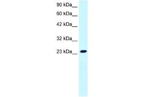 FLJ11730 antibody used at 0. (FLJ11730 (N-Term) Antikörper)