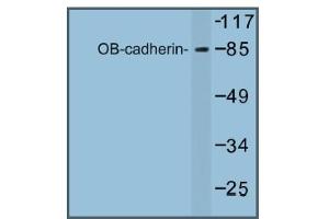 Image no. 1 for anti-Cadherin 11 (CDH11) antibody (ABIN317681) (OB Cadherin Antikörper)