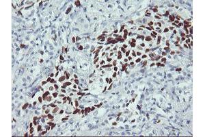 Immunohistochemistry (IHC) image for anti-Tumor Protein P53 (TP53) antibody (ABIN1499978) (p53 Antikörper)