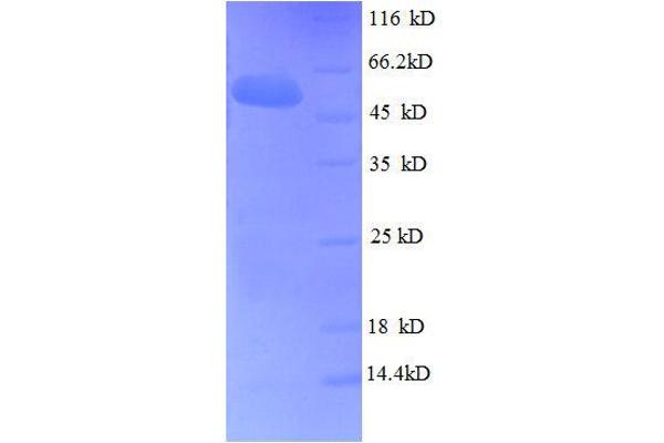 FGF5 Protein (AA 18-268, full length) (GST tag)