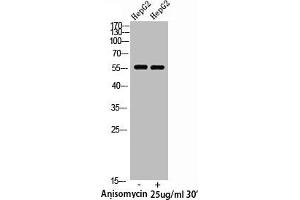 Western Blot analysis of HepG2 cells using Phospho-XIAP (S87) Polyclonal Antibody (XIAP Antikörper  (pSer87))