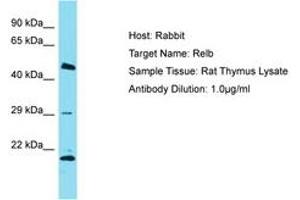 Image no. 1 for anti-V-Rel Reticuloendotheliosis Viral Oncogene Homolog B (RELB) (AA 380-429) antibody (ABIN6750252) (RELB Antikörper  (AA 380-429))