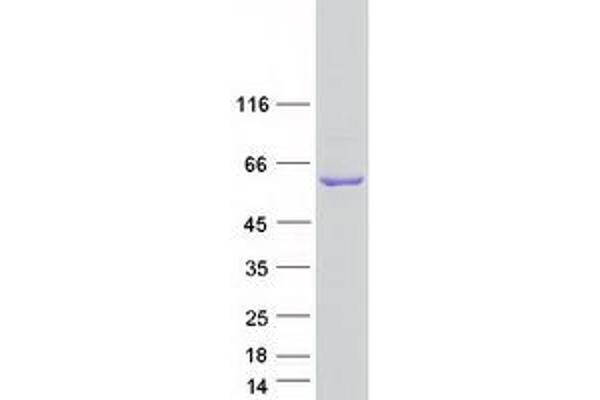 FMO3 Protein (Transcript Variant 1) (Myc-DYKDDDDK Tag)