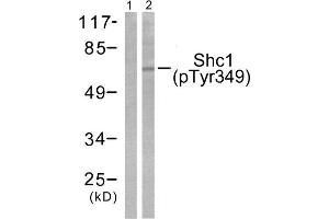 Western Blotting (WB) image for anti-SHC (Src Homology 2 Domain Containing) Transforming Protein 1 (SHC1) (pTyr349) antibody (ABIN1847214) (SHC1 Antikörper  (pTyr349))