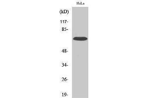 Western Blotting (WB) image for anti-Interleukin 17 Receptor C (IL17RC) (C-Term) antibody (ABIN3175627) (IL17RC Antikörper  (C-Term))