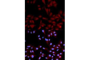 Immunofluorescence (IF) image for anti-Mitogen-Activated Protein Kinase 14 (MAPK14) (pTyr182) antibody (ABIN1870378) (MAPK14 Antikörper  (pTyr182))