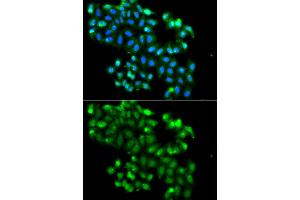 Immunofluorescence analysis of A549 cell using PHF11 antibody. (PHF11 Antikörper)