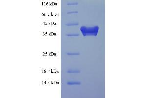 SDS-PAGE (SDS) image for Programmed Cell Death 10 (PDCD10) (AA 1-212), (full length) protein (His-SUMO Tag) (ABIN5711751) (PDCD10 Protein (AA 1-212, full length) (His-SUMO Tag))