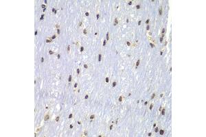 Immunohistochemistry of paraffin-embedded mouse brain using Lyn antibody (ABIN4904272) at dilution of 1:100 (40x lens). (LYN Antikörper)