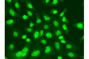 Immunofluorescence analysis of A549 cells using LIG1 antibody. (LIG1 Antikörper)