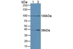 Figure. (ERK1 Antikörper  (AA 75-312))