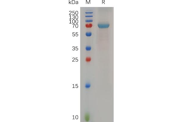 B4GALT1 Protein (Fc Tag)