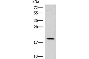 Western blot analysis of Human heart tissue lysate using DNPH1 Polyclonal Antibody at dilution of 1:800 (RCL Antikörper)
