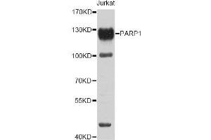 Western blot analysis of extracts of Jurkat cells, using PARP1 antibody (ABIN5995673) at 1/1000 dilution. (PARP1 Antikörper)