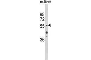 Western blot analysis of HNF1A Antibody (Center) in mouse liver tissue lysates (35ug/lane). (HNF1A Antikörper  (Middle Region))