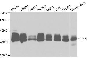 Western blot analysis of extracts of various cell lines, using TPP1 antibody. (TPP1 Antikörper)