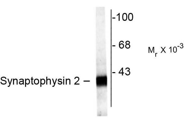 Synaptoporin Antikörper  (C-Term)