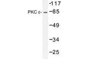 Western blot analysis of PKC ε antibody in extracts from HeLa cells. (PKC epsilon Antikörper)