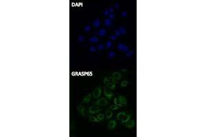 Immunofluorescence (IF) image for Donkey anti-Rabbit IgG antibody (FITC) (ABIN2667148) (Esel anti-Kaninchen IgG Antikörper (FITC))