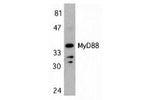 Western Blotting (WB) image for anti-Myeloid Differentiation Primary Response Gene (88) (MYD88) (Middle Region) antibody (ABIN1031006) (MYD88 Antikörper  (Middle Region))
