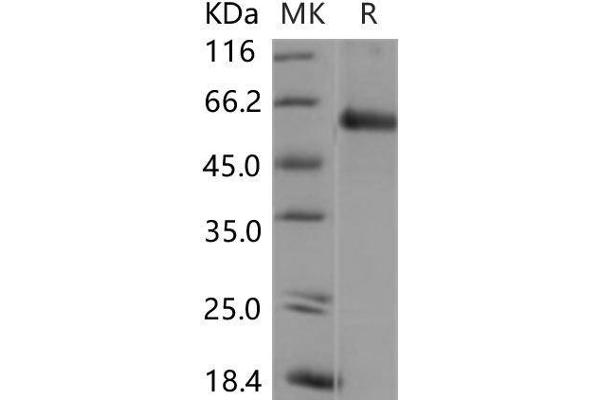 SMAD5 Protein