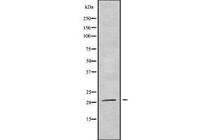 TRAPPC5 Antikörper  (Internal Region)