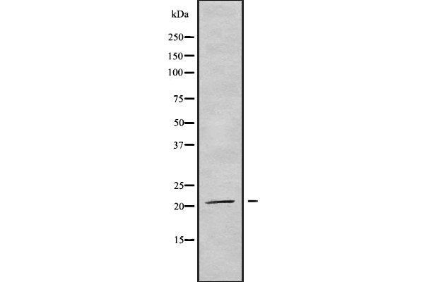 TRAPPC5 Antikörper  (Internal Region)