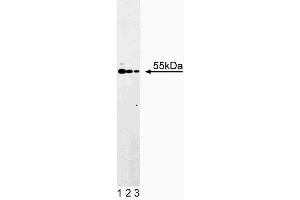 Western blot analysis of ATP Synthase alpha on Jurkat cell lysate. (ATP Synthase alpha (AA 113-220) Antikörper)