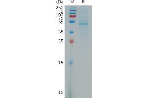 Human PDGFD(250-370) Protein, hFc Tag on SDS-PAGE under reducing condition. (PDGFD Protein (AA 250-370) (Fc Tag))