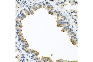 Immunohistochemistry of paraffin-embedded mouse lung using SERPINA3 antibody. (SERPINA3 Antikörper  (AA 24-423))